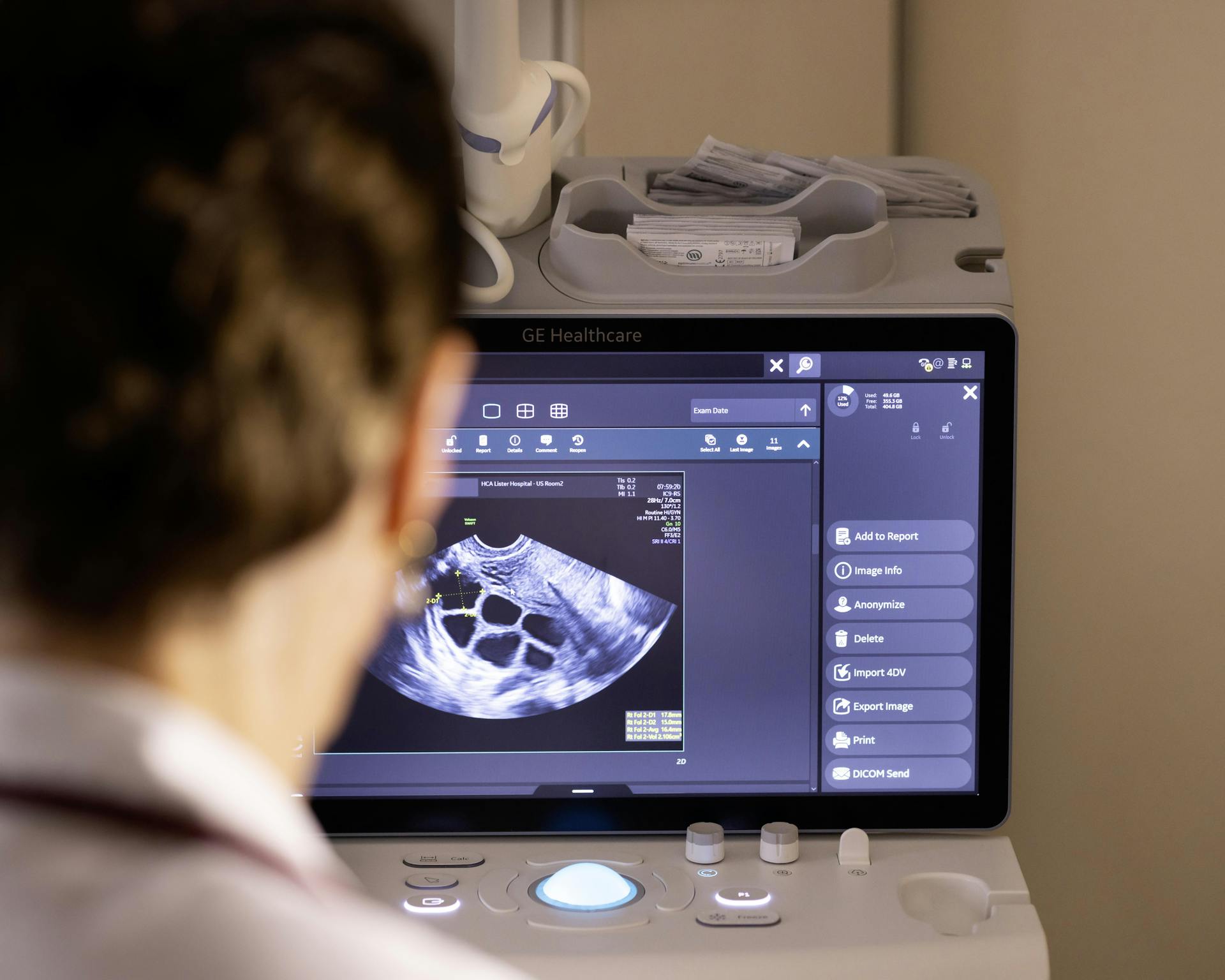 Fertility ultrasound