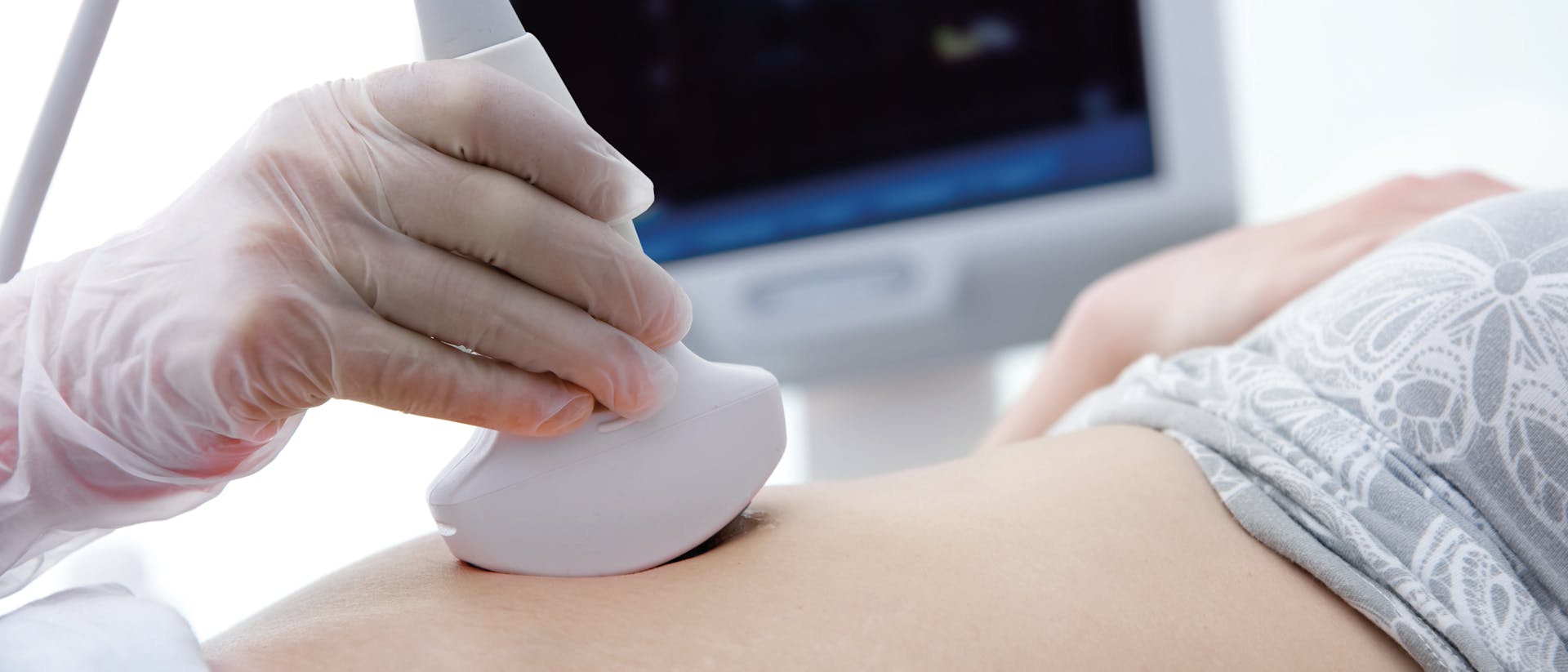 ultrasound_scan_pregnancy