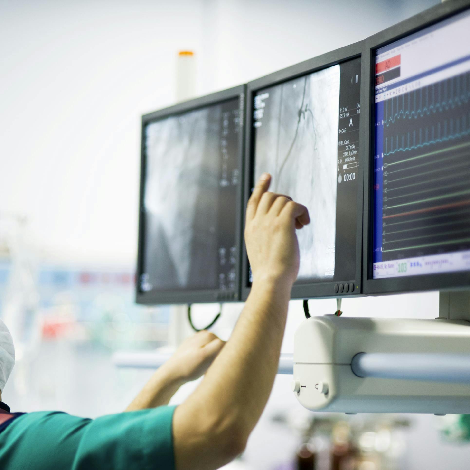 Checking images during a cath lab procedure