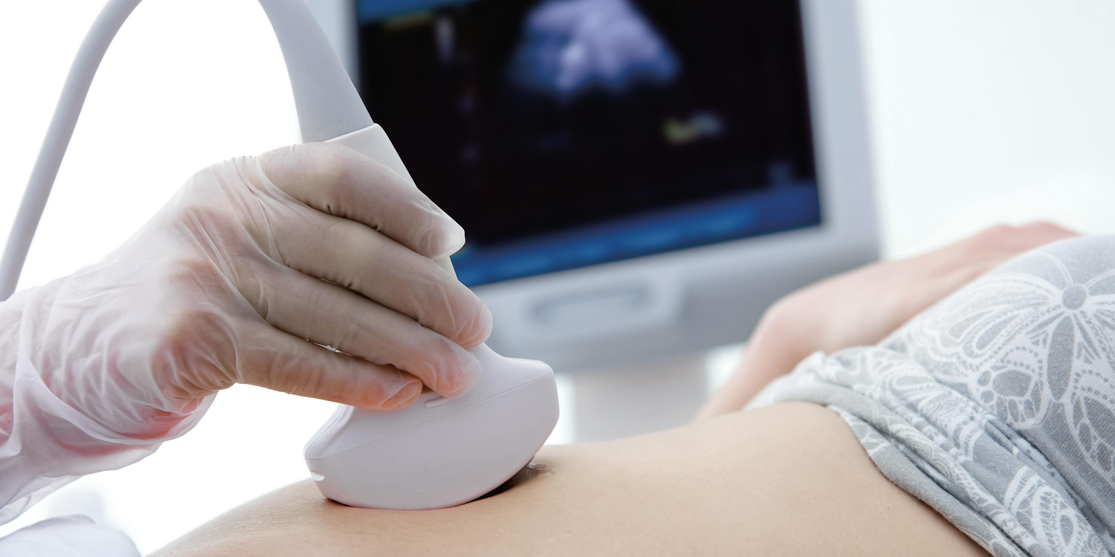 patient_1_ultrasound_scan_pregnant_pregnancy_08_2017_TPH_MOC